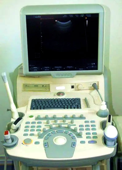 ecograf doppler