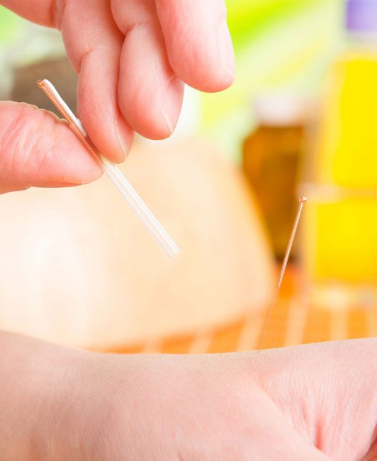 acupunctura zhendao