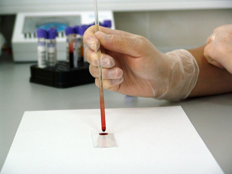 analize de sange interpretare si rezultate