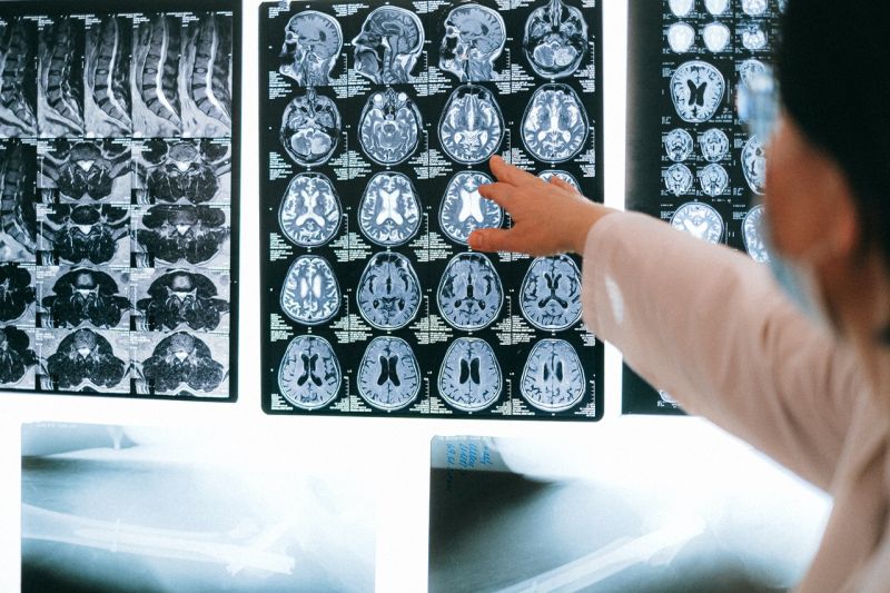 analize pentru boli neurologice